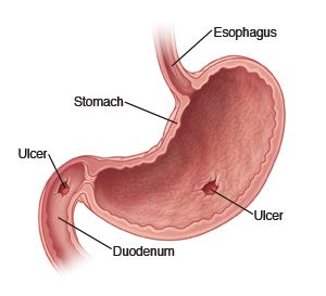 A diagram showing parts of the stomach